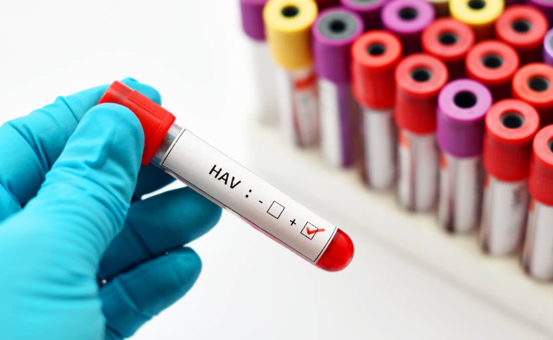 Hepatitis A virus (HAV) positive. Photo: Shutterstock