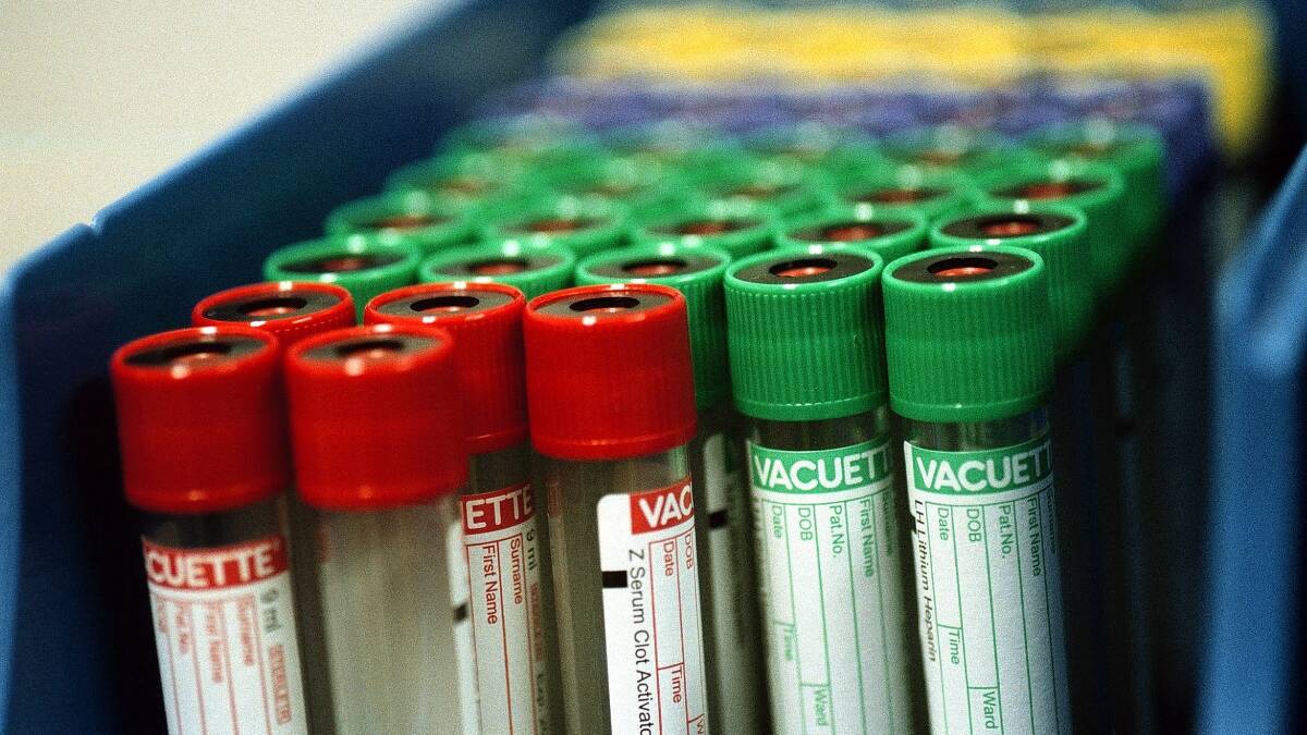 Home tests way ahead for diagnosis