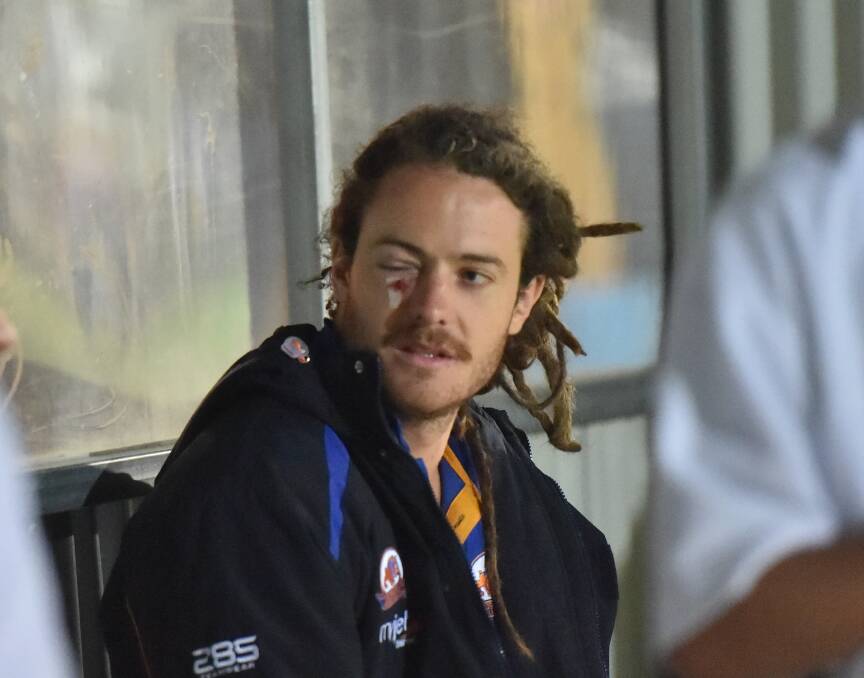 Jack Geary on the bench after injuring his eye in Saturday night's loss to Sandhurst. Picture: ADAM BOURKE