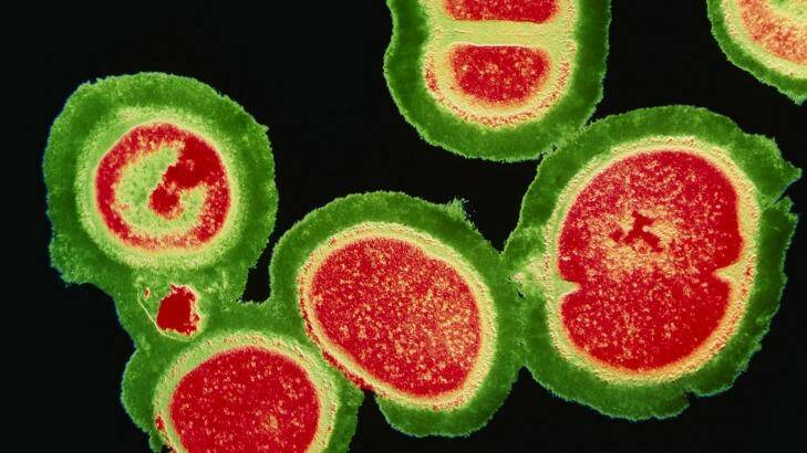 A deadly cluster of resistant staphylococcus bacteria. Photo: Science Photo Library
