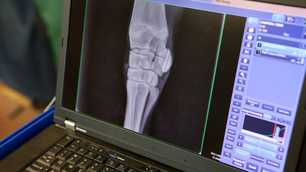 RESULTS: The X-ray of Tiser's knee.