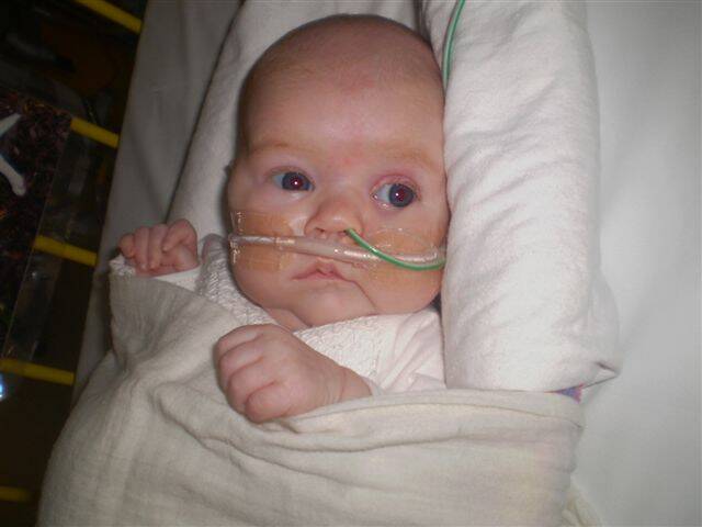 Peggy at eight weeks old, when she had been taken off a lot of equipment but still needed breathing support and required a nasal gastric tube to be fed.