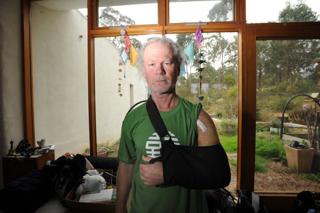 Maurice Kennedy sustained multiple shoulder fractures and underwent surgery after a dog ran into the path of his bicycle at the Castlemaine velodrome in July. Picture: NONI HYETT