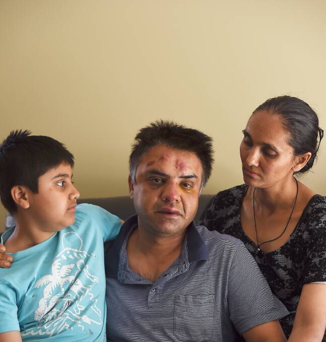 BATTERED: Mr Anand is comforted by his wife Mandeep and 10-year-old son Yash following MOnday's incident.