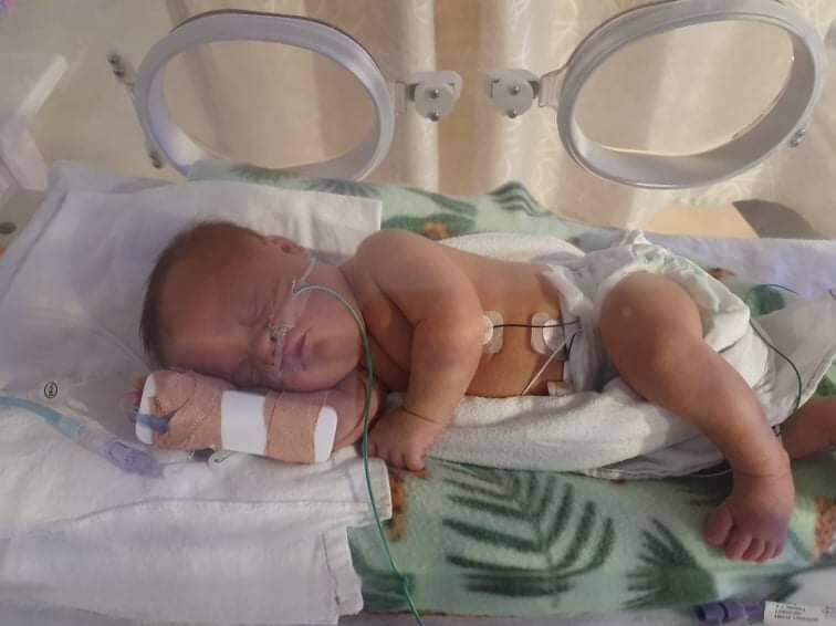 Baby Avahlee has proven to be a little survivor. Picture: SUPPLIED