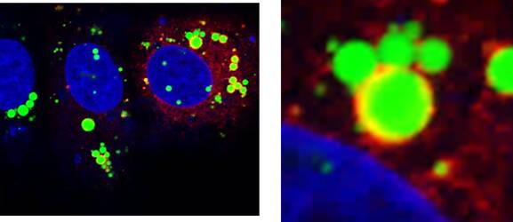 Left: Cells (in blue) under a less powerful flouresence microscope. Red and green shows different proteins. Right: a close up showing yellow, potentially indicating where proteins are mixing. Picture: SUPPLIED