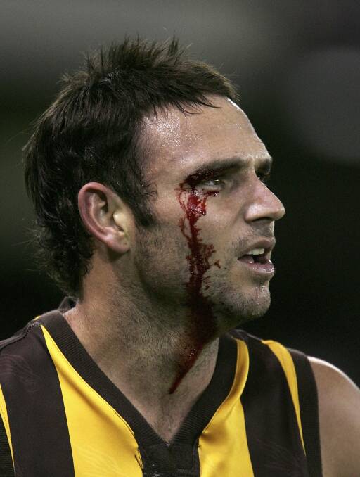 A cut eye during the clash with St Kilda in round 13, 2006. Picture: GETTY IMAGES