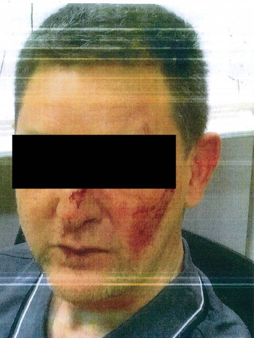 One of the staff members assaulted in the attack